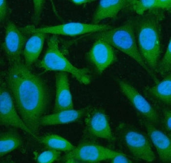 Immunofluorescent staining of FFPE human PC-3 cells with LYPLA2 antibody (green) and DAPI nuclear st