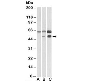CAMK2A Antibody