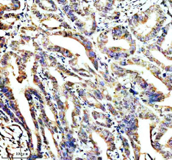 IHC staining of STOML2 using anti-STOML2 antibody. STOML2 was detected in a paraffin-embedded sectio