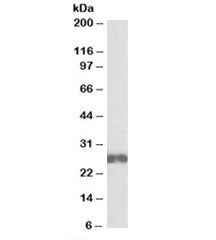 D4-GDI Antibody