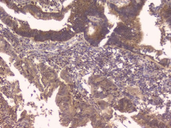 IHC staining of FFPE human placenta with TNFRSF11B antibody. HIER: boil tissue sections in pH6, 10mM