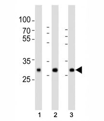 Western blot analysis of lysate from human (1) placenta, (2) lung, (3) kidney tissue lysate using SO