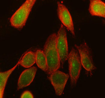 Immunofluorescent staining of RPS6KA3 using anti-RPS6KA3 antibody (green) and anti-Beta Tubulin anti