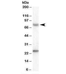 Western blot testing of human liver lysate with LGP2 antibody at 0.3ug/ml. Predicted molecular weigh