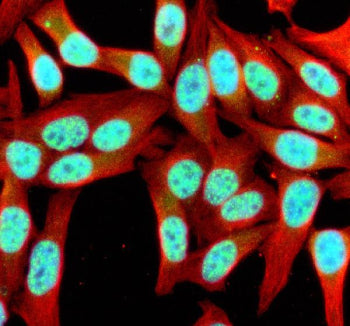 Immunofluorescent staining of SIK1 using anti-SIK1 antibody (green) and anti-Beta Tubulin antibody (