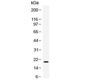 TREML1 Antibody