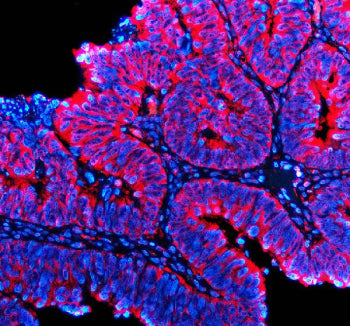 TTF2 Antibody / Transcription termination factor 2, 100ug