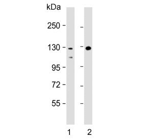Western blot testing of human 1) Raji and 2) HL60 cell lysate with TERT antibody. Predicted molecula