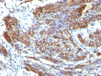 Caldesmon / CAD Antibody HMW