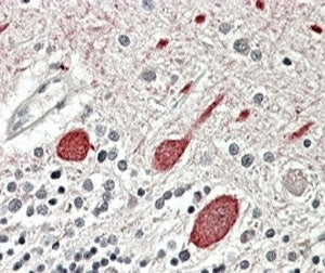 IHC testing of FFPE human cerebellum with Melatonin receptor 1B antibody at 4ug/ml. HIER: steamed wi