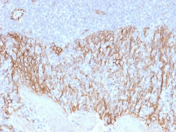 IHC testing of FFPE human tonsil tissue with Beta Catenin antibody (clone CTNNB1/2099). HIER: boil t