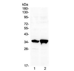 Western blot testing of 1) rat brain and 2) mouse brain with Six3 antibody at 0.5ug/ml. Predicted mo