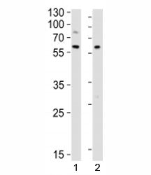 Western blot analysis of lysate from 1) Raji and 2) Ramos cell lines using LYN antibody at 1:1000. P