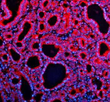 Immunofluorescent staining of TENM2 using anti-TENM2 antibody (red). TENM2 was detected in a paraffi