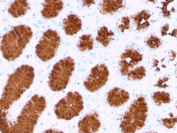 IHC staining of FFPE human colon with recombinant MUC5AC antibody (clone rMUC5AC/3779). HIER: boil t