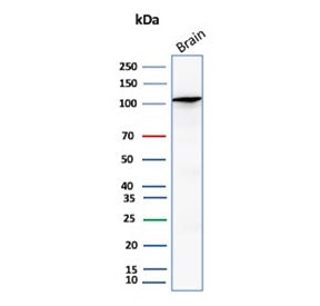 Western blot testing of human brain tissue lysate with HK1 antibody (clone HK1/9509). Predicted mole