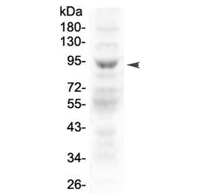 MAP3K20 Antibody