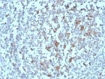 IHC staining of FFPE human tonsil with BAFF-R antibody. HIER: boil tissue sections in pH 9 10mM Tris