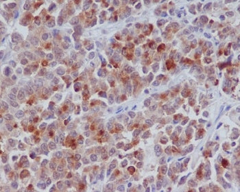 Cyclin B1 Antibody / CCNB1