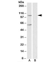 Western blot testing of human liver lysate with IRP2 antibody at 0.3ug/ml in the A) absence and B) p