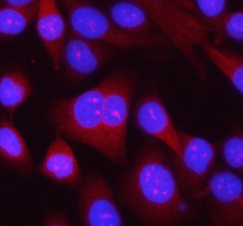 Immunofluorescent staining of RPL14 using anti-RPL14 antibody (red). RPL14 was detected in an immuno