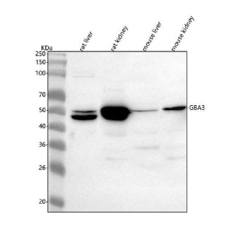 Western blot analysis of GBA3 using anti-GBA3 antibody. Lane 1: rat liver tissue lysates, Lane 2: ra