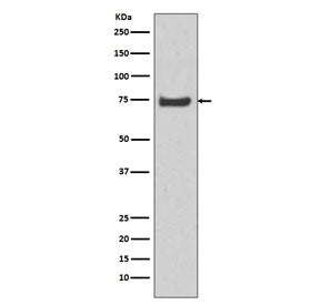 HSPA12A Antibody / Heat shock 70 kDa protein 12A