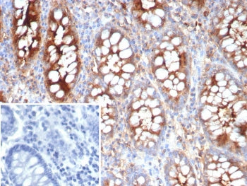 IHC staining of FFPE human colon tissue with Carcinoembryonic antigen-related cell adhesion molecule
