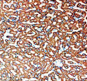Immunohistochemical staining of SNX16 using anti-SNX16 antibody. SNX16 was detected in a paraffin-em
