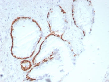 Cytokeratin 14 Antibody / CK14 / KRT14
