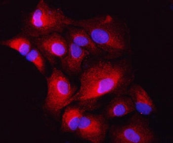 Immunofluorescent staining of FFPE human A549 cells with ZIP7 antibody (red) and DAPI nuclear stain