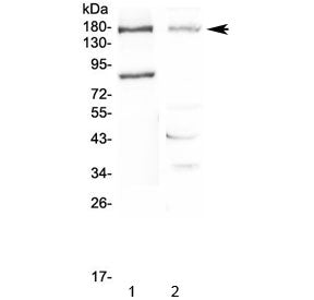 Western blot testing of 1) rat pancreas and 2) mouse NIH 3T3 lysate with NPC1 antibody at 0.5ug/ml.