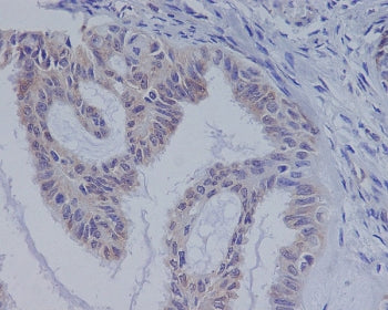 BRAF Antibody