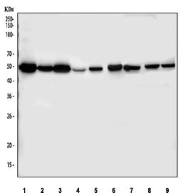 Fascin Antibody