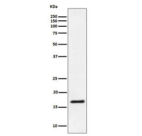 Western blot testing of human Jurkat cell lysate with UBE2L3 antibody. Predicted molecular weight ~1