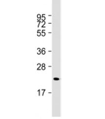 Western blot testing of human skeletal muscle lysate with FNDC5 antibody at 1:2000. Predicted molecu