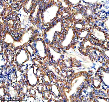 Immunohistochemical staining of PARP16 using anti-PARP16 antibody. PARP16 was detected in a paraffin