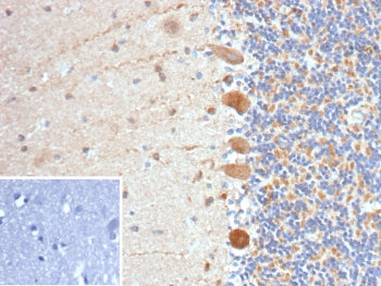 IHC staining of FFPE human brain tissue with FLT3 antibody (clone FLT3/9883). Inset: PBS used in pla