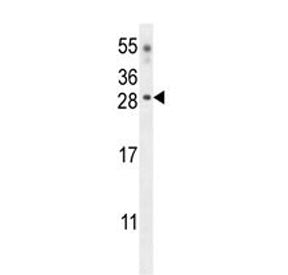 Western blot testing of mouse heart tissue lysate with Claudin 6 antibody. Predicted molecular weigh