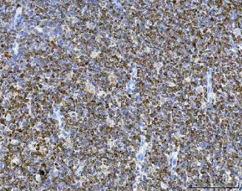 IHC staining of FFPE human tonsil tissue with CD74 antibody. HIER: boil tissue sections in pH8 EDTA