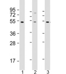 Western blot testing of human 1) HT-1080, 2) SH-SY5Y and 3) Y79 cell lysate with ZNF513 antibody at