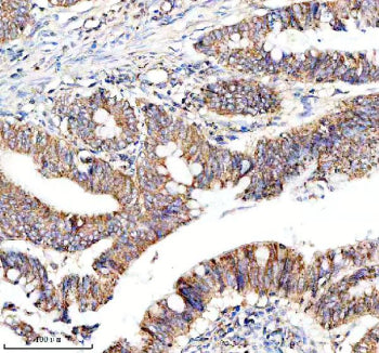Immunohistochemical staining of NDUF-S2 using anti-NDUF-S2 antibody. NDUF-S2 was detected in a paraf
