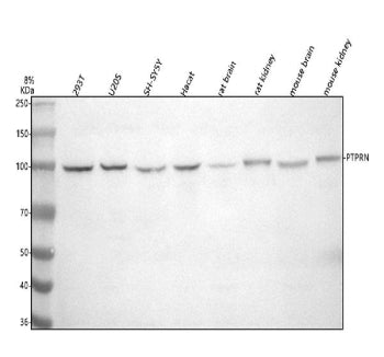 Western blot analysis of PTPRN using anti-PTPRN antibody. Electrophoresis was performed on a 8% SDS-