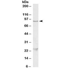 Western blot testing of HeLa lysate with TBK1 antibody at 1ug/ml. The expected ~85kDa band and the a