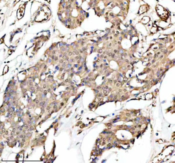 Immunohistochemical staining of PUF60 using anti-PUF60 antibody. PUF60 was detected in a paraffin-em
