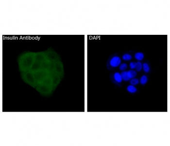 Insulin Antibody