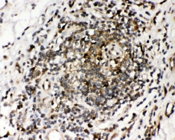 Ribonuclease inhibitor Antibody / RNH1