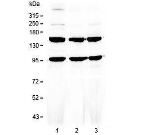 Western blot testing of human 1) HeLa, 2) MCF7 and 3) HepG2 cell lysate with VEGFR3 antibody at 0.5u