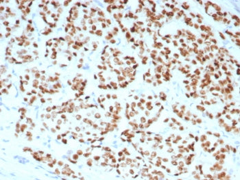 Estrogen Receptor alpha Antibody