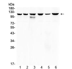 PI3K p110 Antibody (beta)
